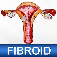 Скачать Uterine Fibroid Treatment Help 2.1 Mod (Pro)